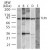 Western blot analysis of TLR5 in (A) Ramos, (B) Raw, (C) mouse spleen, (D) mouse lung and (E) rat lung whole cell lysate using SP7197P at 2 µg/ml.