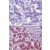 Immunohistochemical staining of TLR6 in Paraffin-Embedded Formalin-Fixed Human liver tissue using an Isotype control (Top) and SM7112P (Bottom) at 5 µg/ml. 
