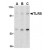 Western blot analysis of TLR5 in THP-1 cell lysate with TLR5 antibody at (A) 0.5, (B) 1 and (C) 2 µg/ml.