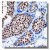 Figure 1. Immunohistochemical staining using PR antibody (AM05312PU-N) on formalin fixed, paraffin embedded human breast carcinoma.