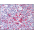Tonsil: Formalin-Fixed Paraffin-Embedded (FFPE)