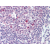 Tonsil: Formalin-Fixed Paraffin-Embedded (FFPE)