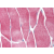 AP07182PU-N AKT1 antiody staining of Formalin-Fixed Paraffin-Embedded Human Skeletal Muscle at 5 µg/ml followed by biotinylated goat anti-rabbit IgG secondary antibody, alkaline phosphatase-streptavidin and chromogen.