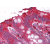 Colon: Formalin-Fixed Paraffin-Embedded (FFPE)