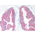 Prostate: Formalin-Fixed Paraffin-Embedded (FFPE)