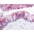 Lung, respiratory epithelium: Formalin-Fixed Paraffin-Embedded (FFPE)