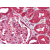 Kidney: Formalin-Fixed Paraffin-Embedded (FFPE)