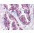 Prostate: Formalin-Fixed Paraffin-Embedded (FFPE)