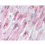 Heart: Formalin-Fixed Paraffin-Embedded (FFPE)