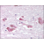Brain, substantia nigra: Formalin-Fixed Paraffin-Embedded (FFPE)
