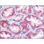 Kidney: Formalin-Fixed Paraffin-Embedded (FFPE)