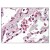Figure 1. Formalin-Fixed Paraffin-Embedded (FFPE) on Lung, Alveolar Macrophages.