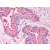 Prostate: Formalin-Fixed Paraffin-Embedded (FFPE)