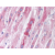 Heart: Formalin-Fixed Paraffin-Embedded (FFPE)