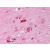 Brain, cortex: Formalin-Fixed Paraffin-Embedded (FFPE)
