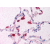 Lung: Formalin-Fixed Paraffin-Embedded (FFPE)