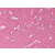 Brain, cortex: Formalin-Fixed Paraffin-Embedded (FFPE)