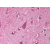 Brain, cortex: Formalin-Fixed Paraffin-Embedded (FFPE)