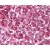 Pancreas: Formalin-Fixed Paraffin-Embedded (FFPE)