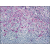 Tonsil: Formalin-Fixed Paraffin-Embedded (FFPE)