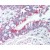 Lung, respiratory epithelium: Formalin-Fixed Paraffin-Embedded (FFPE)