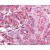 Kidney: Formalin-Fixed Paraffin-Embedded (FFPE)