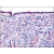 Surface Epithelium: Formalin-Fixed Paraffin-Embedded (FFPE)