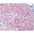 AP07533PU-N SLC2A4 antibody staining of Formalin-Fixed Paraffin-Embedded Human Heart, Cardiac Myocytes at 10-20 µg/ml followed by biotinylated goat anti-rabbit IgG secondary antibody, alkaline phosphatase-streptavidin and chromogen. 
  
