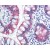 Small intestine: Formalin-Fixed Paraffin-Embedded (FFPE)