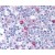 Tonsil: Formalin-Fixed Paraffin-Embedded (FFPE)