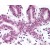 AP07470PU-N RAD17 antibody staining of Formalin-Fixed Paraffin-Embedded Human Breast at 1/50 followed by biotinylated goat anti-rabbit IgG secondary antibody, alkaline phosphatase-streptavidin and chromogen.