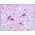 Brain, cortex: Formalin-Fixed Paraffin-Embedded (FFPE)