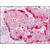 AP07100PU-N CD220/INSR antibody staining of Formalin-Fixed Paraffin-Embedded Human Pancreas, Islet of Langerhans at 10 µg/ml followed by biotinylated Goat anti-Rabbit IgG secondary antibody, Alkaline Phosphatase-Streptavidin and Chromogen.