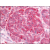 AP07101PU-N CD220/INSR antibody staining of Formalin-Fixed Paraffin-Embedded Human Pancreas, Islet of Langerhans at 10 µg/ml followed by biotinylated Goat anti-Rabbit IgG secondary antibody, Alkaline Phosphatase-Streptavidin and Chromogen.