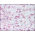 Skin, granulation tissue: Formalin-Fixed Paraffin-Embedded (FFPE)