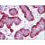 Breast: Formalin-Fixed Paraffin-Embedded (FFPE)