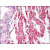 Prostate: Formalin-Fixed Paraffin-Embedded (FFPE)