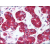 Breast: Formalin-Fixed Paraffin-Embedded (FFPE)