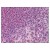 Figure 1. AP07922PU-N CD278/ICOS antibody staining of Formalin-Fixed, Paraffin-Embedded Human Spleen tissue.