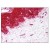 Figure 1. Staining MMP2 in Skin, Fibroblasts 
by Immunohistochemistry using Formalin-Fixed Paraffin-Embedded (FFPE) tissue.
