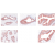 Immunohistochemistry of Kallikrein-2 (hK2) using clone 6B7 on formalin fixed paraffin embedded sections of Human prostate.