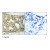 Figure 1. Immunohistochemical analysis of paraffin-embedded human breast carcinoma tissue using Androgen Receptor pSer650 antibody (AP08009PU).