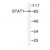 Western blot (WB) analysis of STAT1 pTyr701 antibody in extracts from MCF7 cells.