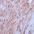 Leiomyoma stained with Anti-beta Actin
