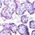 Human placenta stained with Anti-Flk-1 antibody