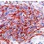 Human esophagous carcinoma stained with Anti-GLUT-1 antibody