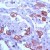 Human lung stained with Anti-Keratin 8 antibody