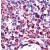 Human tonsil stained with anti-Bak