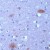 Human brain stained with Anti-alpha-Synuclein antibody