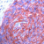 Human esophagous stained with anti-GLUT1 antibody (Cat#AM11138PU)